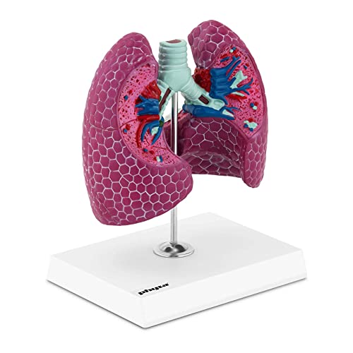 physa PHY-LM-1 Lungenmodell 1:1 Organmodell menschliche Lunge anatomisches Modell von Krebs befallen von physa wellness & lifestyle