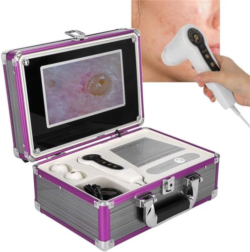 GYQSSD Hautdiagnose-Haaranalysator, Hauthaar-Kopfhautdetektor, Digitalmikroskop-Kopfhaut-Haarfollikel-Detektor, mit 7 Griffen, LCD-Bildschirm, Gesichtshautdiagnosesystem für Salon Spa von GYQSSD